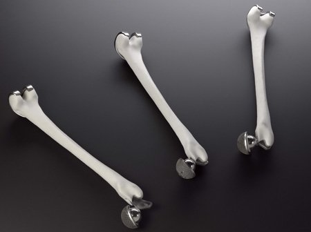 3D printed printed hip and knee implants. Photo: Science Museum // Renishaw plc.